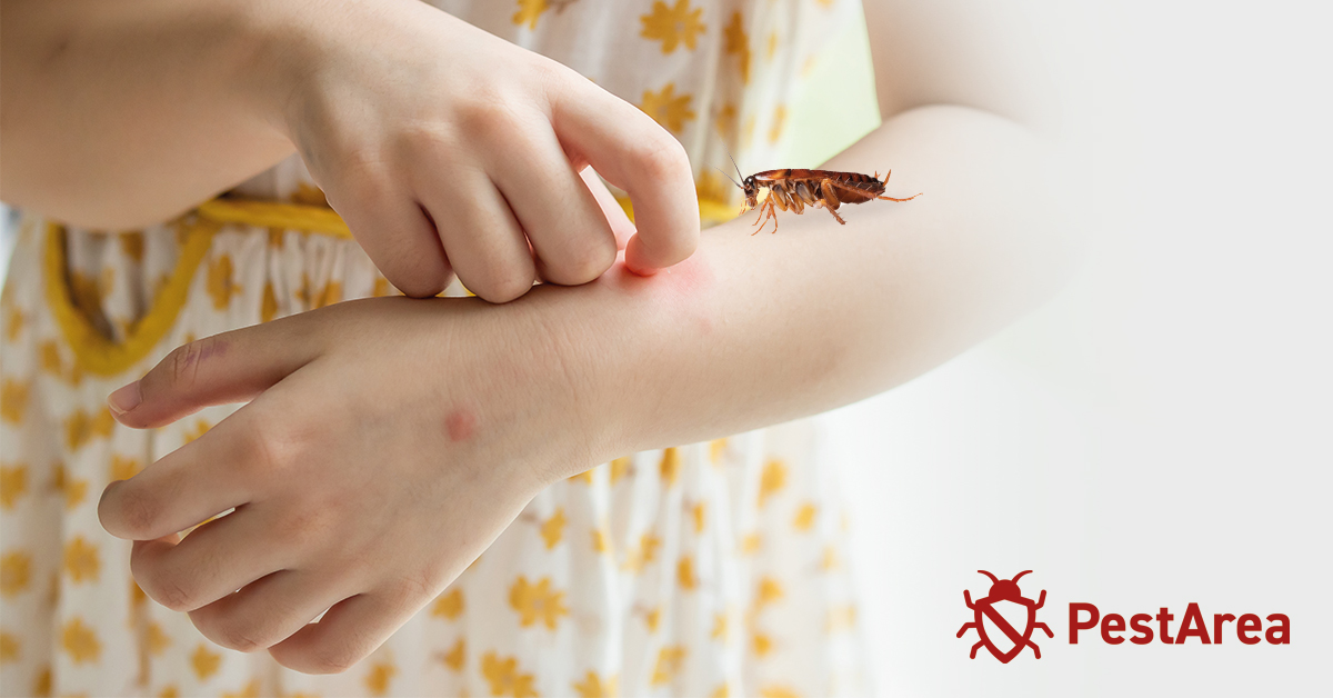 Roach on a woman arm